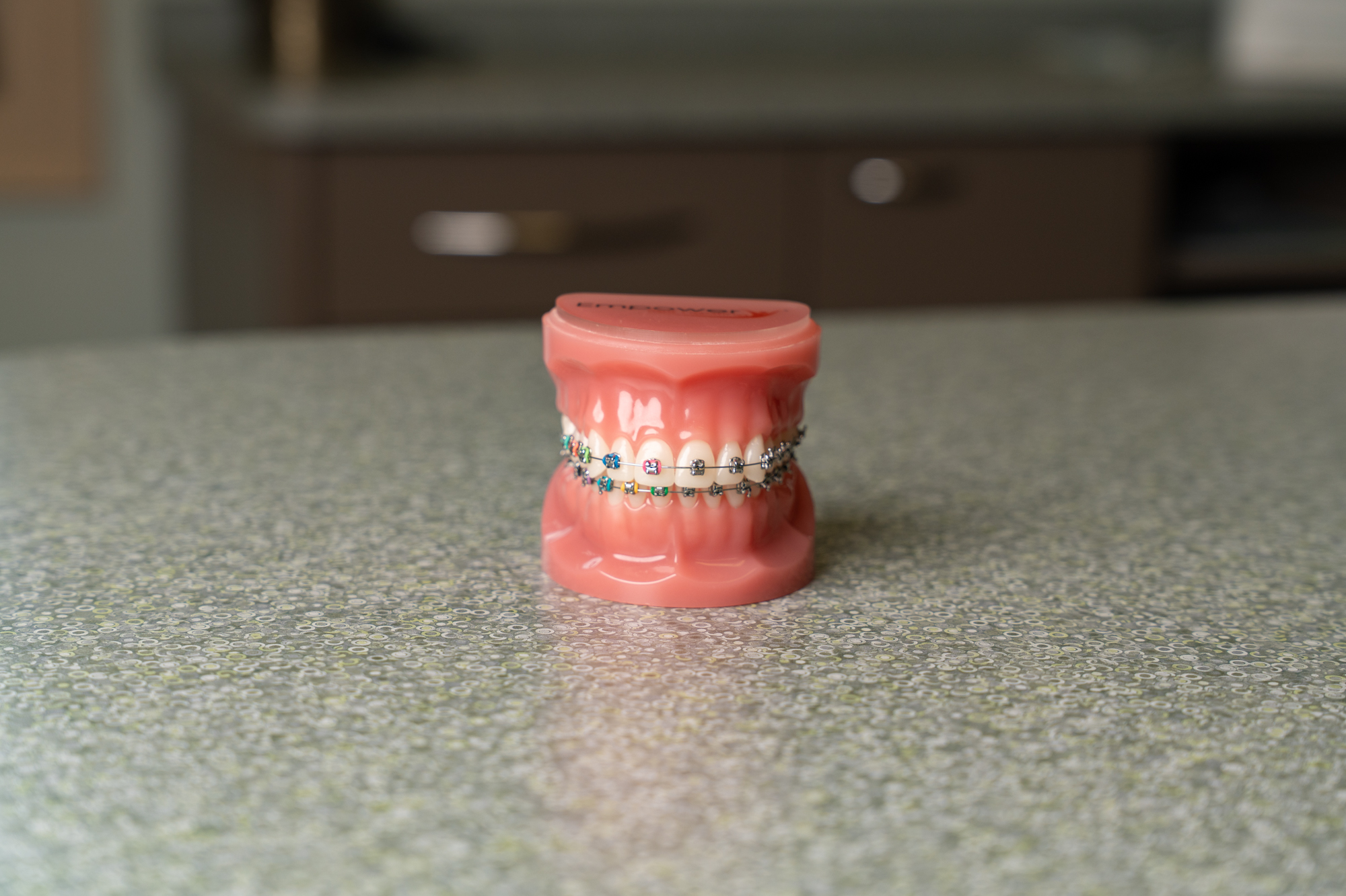 Metal Braces
